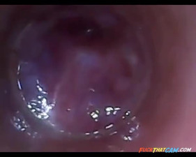 test tube cock endoscope POV urethral insertion ball rod