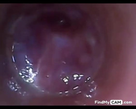 test tube cock endoscope POV urethral insertion ball rod