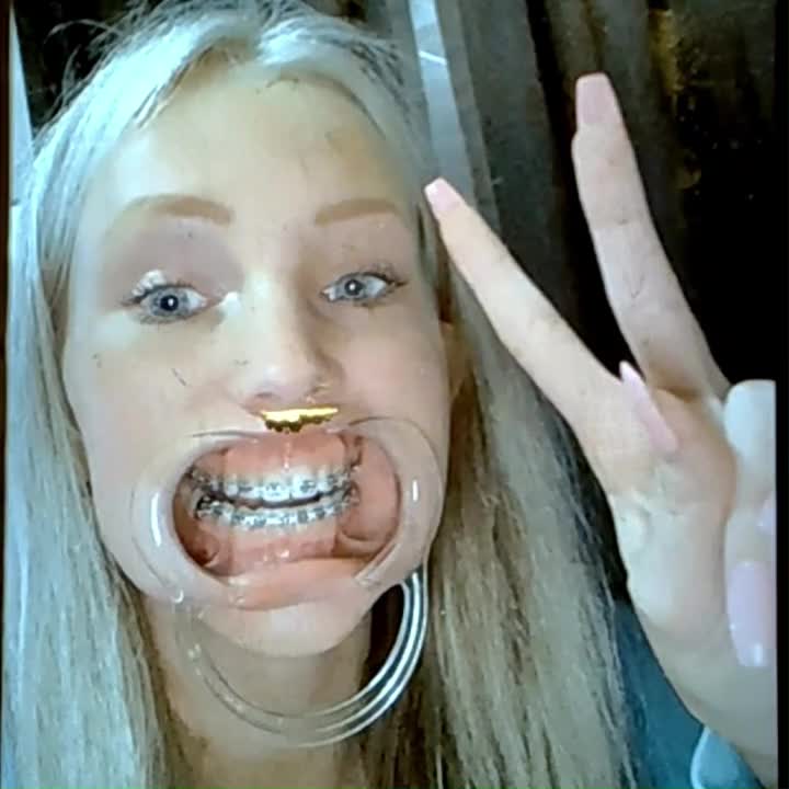 Watch cocaine tribute stupid kawaii petite teen dental gag drooling Short Sex Videos - Duration: 00:25 | ePornNEW.