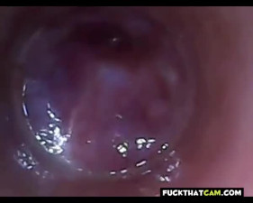 test tube cock endoscope POV urethral insertion ball rod